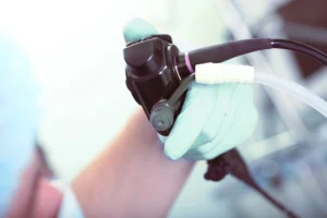 Procedure for Colonoscopy